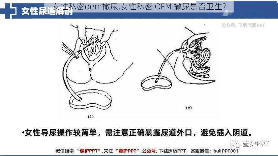 女性私密oem撒尿,女性私密 OEM 撒尿是否卫生？