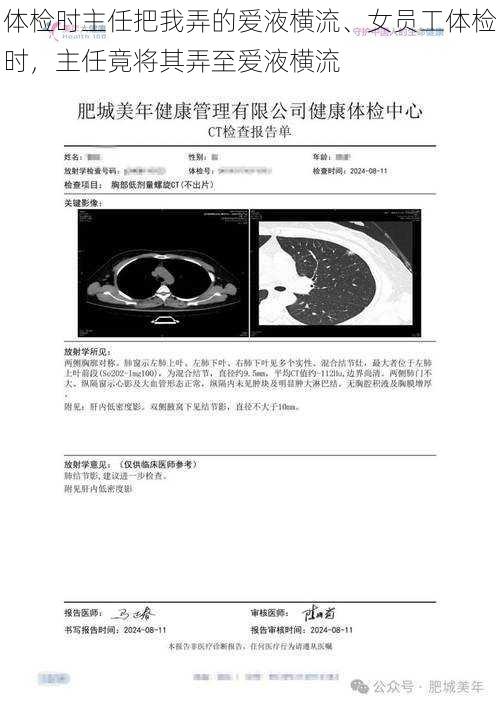 体检时主任把我弄的爱液横流、女员工体检时，主任竟将其弄至爱液横流